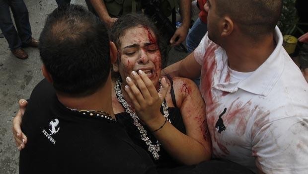 Nạn nhân bị thương trong vụ đánh bom ở Beirut